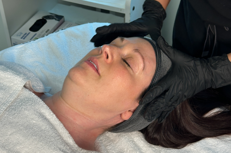 Picture of a client receiving peeling